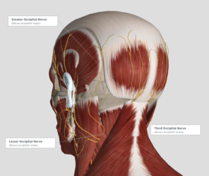 Anatomy of an occipital nerve decompression on our way to a migraine cure