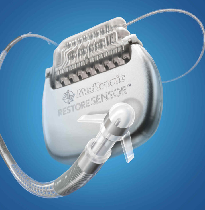 occipital nerve stimulator