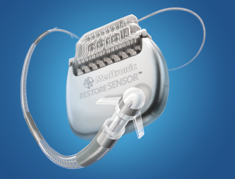 Migraine Surgery vs Reed Procedure vs Omega Procedure