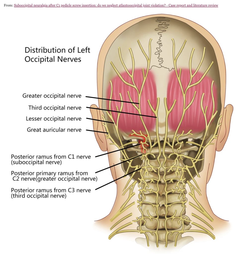 Spinal Surgery Vs Migraine Surgery Dr Adam Lowenstein